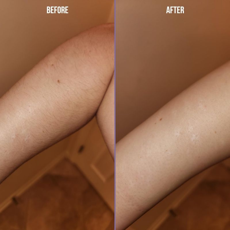 Olmera Hair Removal Cream